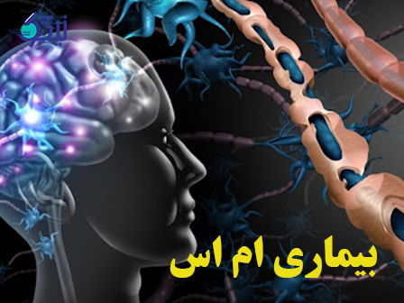 مولتیپل اسکلروزیس (MS)