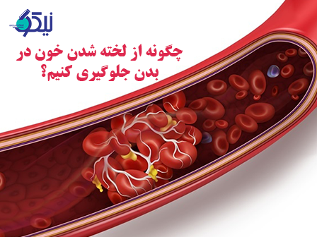 چگونه از لخته شدن خون در بدن جلوگیری کنیم؟