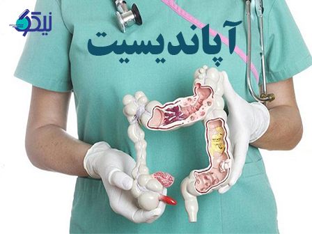 آپاندیسیت