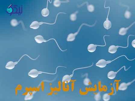 آزمایش آنالیز اسپرم 