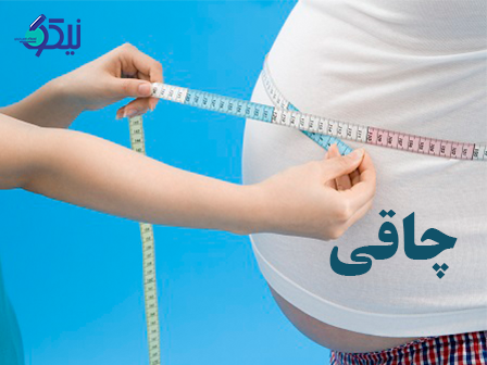 چاقی