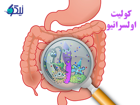 جوابدهي آنلاين براي آزمايش تشخيص کوليت اولسراتيو در آزمايشگاه نيکو