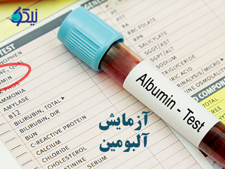 چرا باید آزمایش آلبومین انجام‌شود؟
