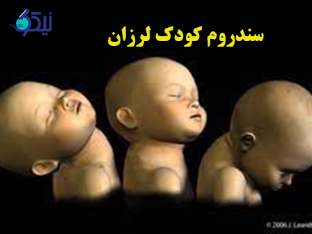 تکان دادن نوزادان چه خطراتی دارد؟