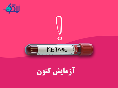 آزمایش کتون را می توان بصورت نمونه گیری در منزل انجام داد؟