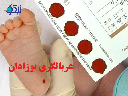 غربالگری نوزادان
