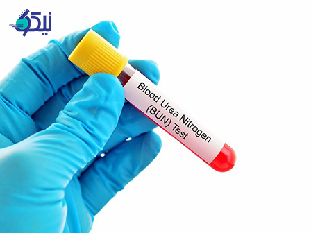 آزمایش نیتروژن اوره خون