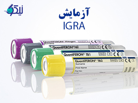 تست IGRA چیست و چه کاربردی دارد؟
