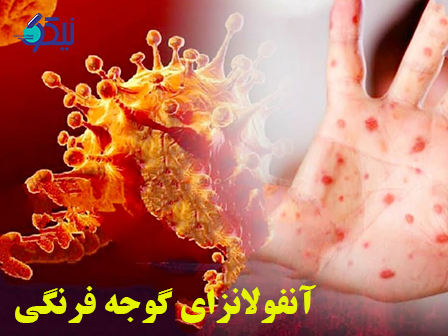 آنفلونزای گوجه فرنگی (تب گوجه فرنگی) چه علائمی را ایجاد می کند؟