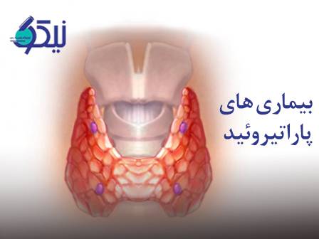 بیماری‌های پاراتیروئید؛ وقتی تعادل کلسیم بدن به هم می‌ریزد!