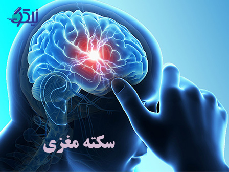 سکته مغزی را زود تشخیص بده، جان را نجات بده!