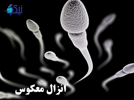 انزال رتروگرادیا انزال معکوس چیست؟