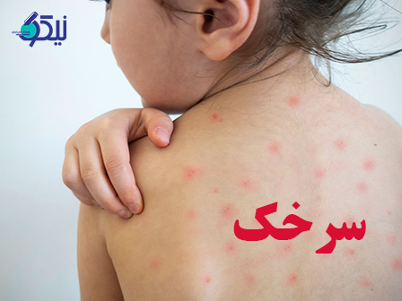 سرخک