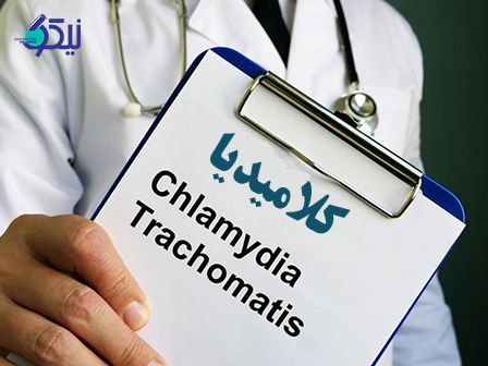 از عفونت کلامیدیا چه میدانید؟
