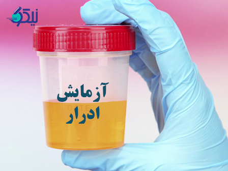 در مجهزترین آزمایشگاه تهران آزمایش ادرارچگونه بررسی می شود؟