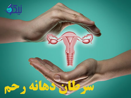 چگونه از سرطان رحم پیشگیری کنیم؟