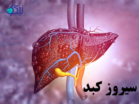 سیروز‌ کبد چیست؟