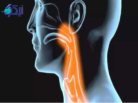 دیسفاژی چه علائمی دارد؟