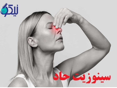 سینوزیت حاد(عفونت سینوس) چیست؟