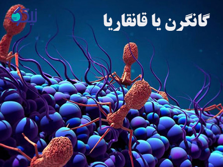 گانگرن یا قانقاریا چیست؟