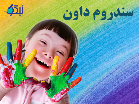 آیا آزمایش سندرم داون با خونگیری در منزل امکانپذیز می باشد؟
