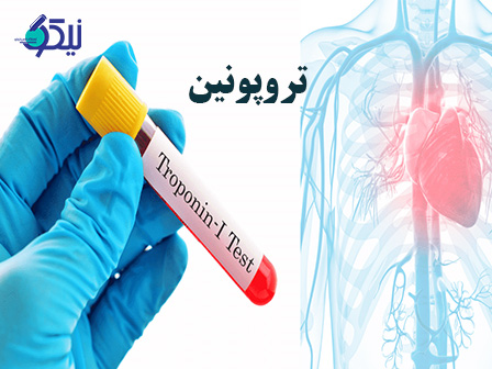 آیا آزمایش تروپونین در پیش بینی حمله قلبی موثر است؟