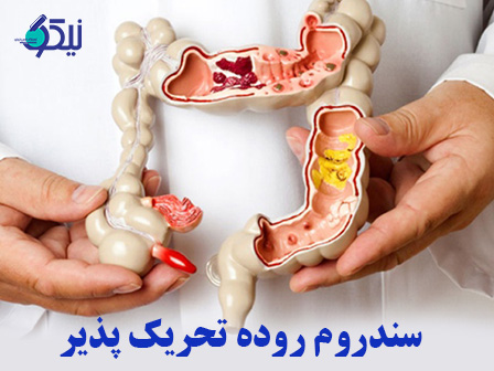 سندرم روده تحریک‌پذیر: علت، علائم و مدیریت آن