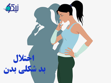 اختلال بدشکلی بدن چیست؟