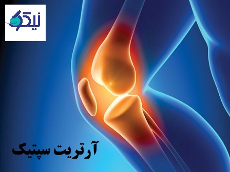 آرتریت سپتیک چه علائمی دارد؟