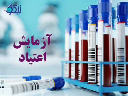 چگونه از جوابدهی آنلاین در آزمایش اعتیاد استفاده کنیم؟