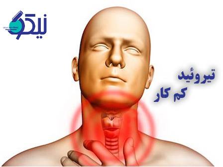 باور نمی‌کنی که این غذاها تیروئید کم‌کار را بیدار می‌کند!