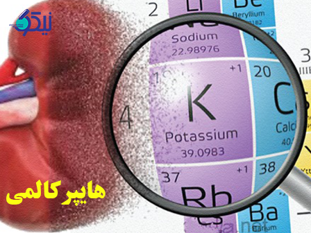هایپر کالمی چیست؟