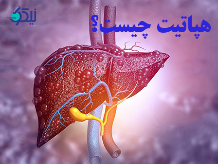 هپاتیت چیست؟(جوابدهی آنلاین برای آزمایش تشخیص هپاتیت)