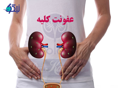 عفونت کلیه (پیلونفریت) چیست؟