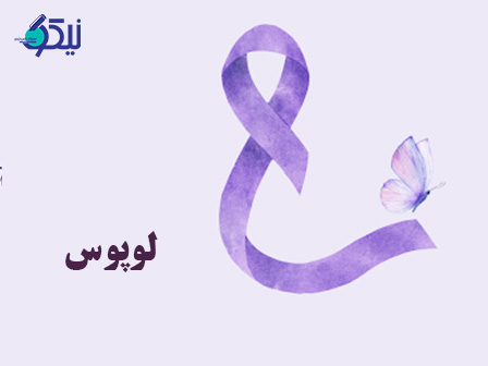 لوپوس؛ راز بیماری هزار چهره و تشخیص آن